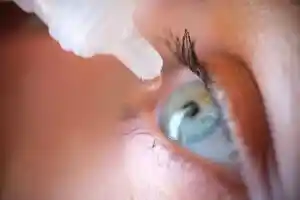 Dépistage du glaucome par un ophtalmologue