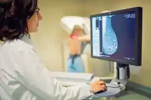 Cancer du sein : à quel âge faire sa première mammographie ?
